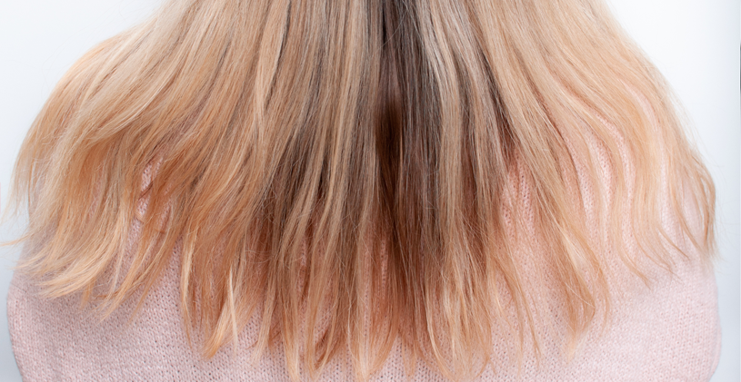 Before Hair Treatment